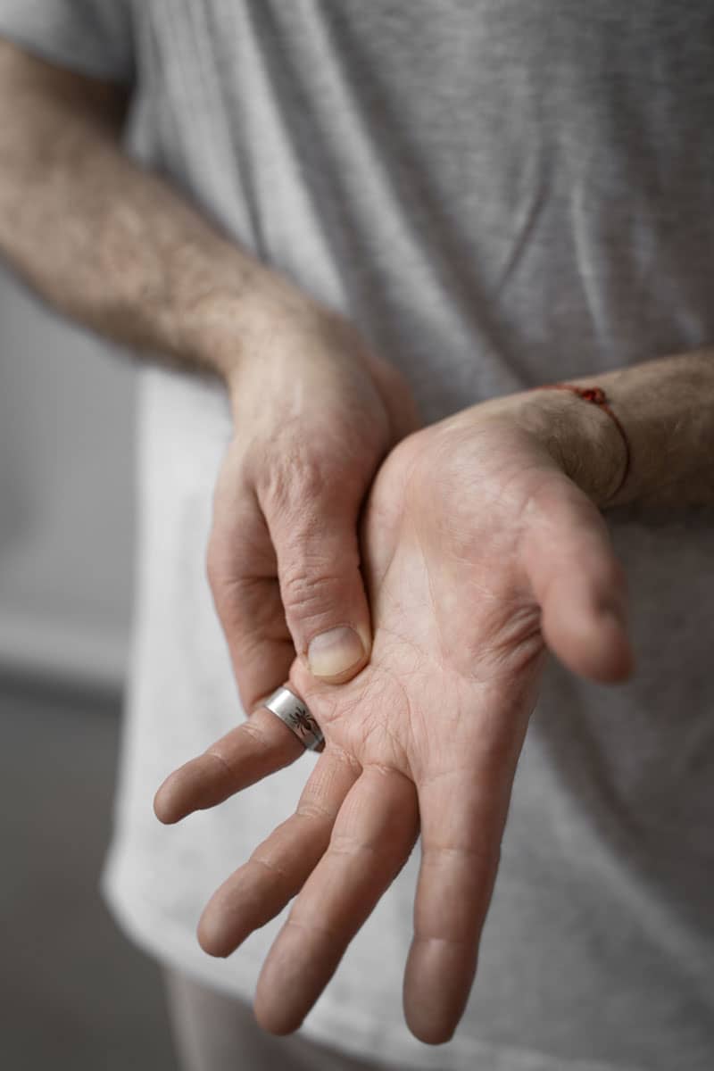 Seronegative Arthritis